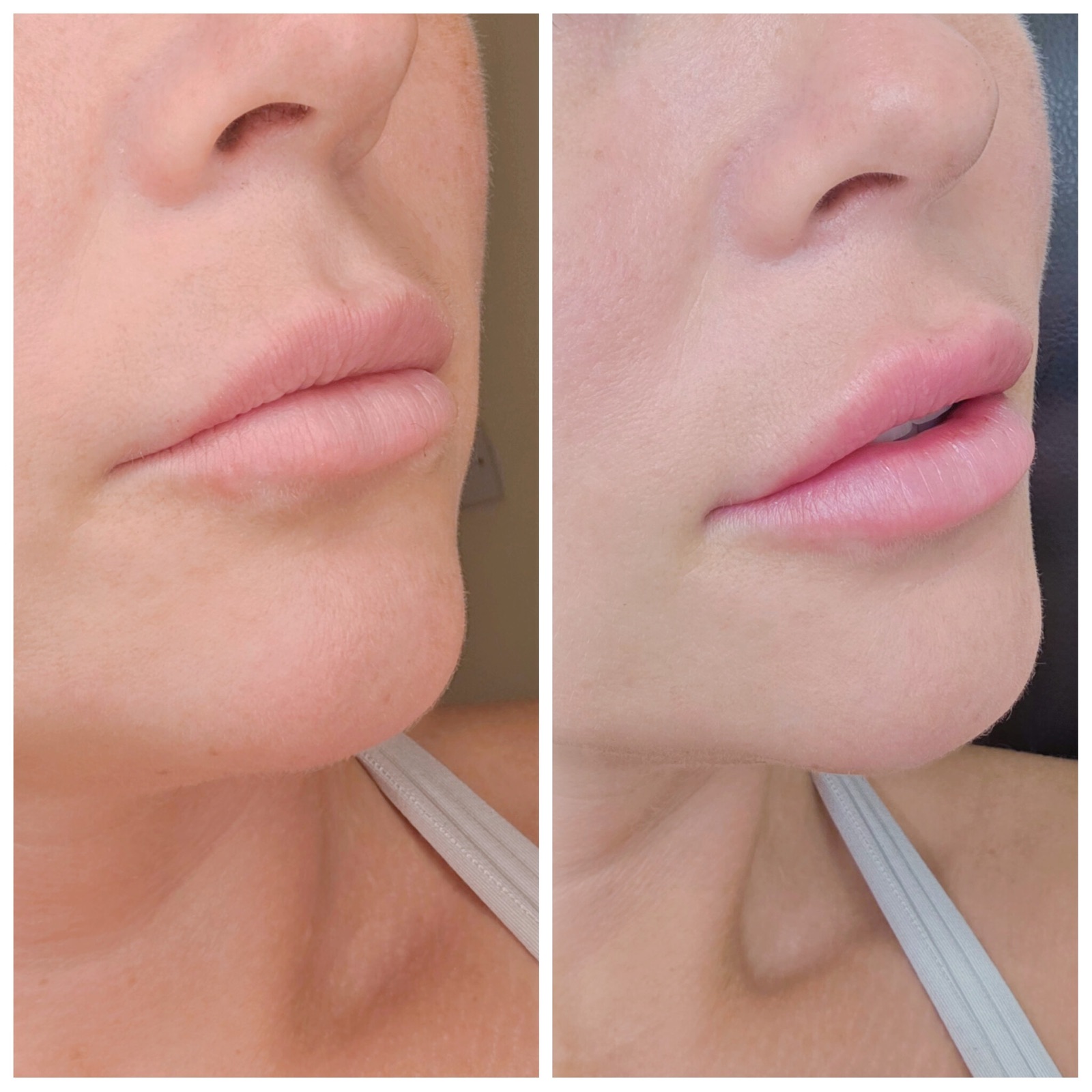 Treatment result