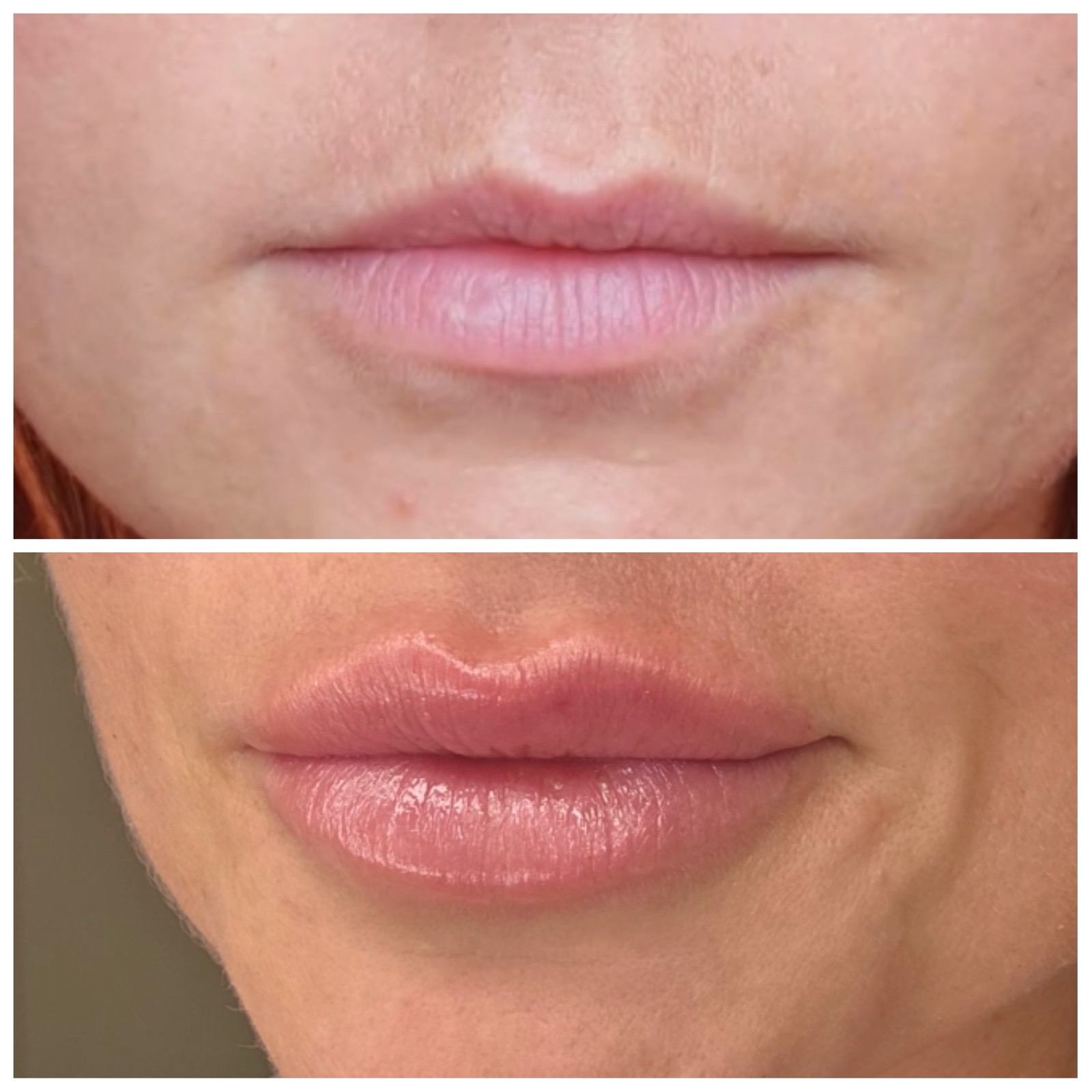 Treatment result