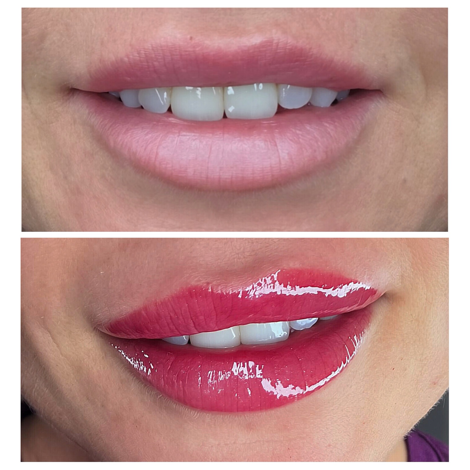Aesthetic treatment result
