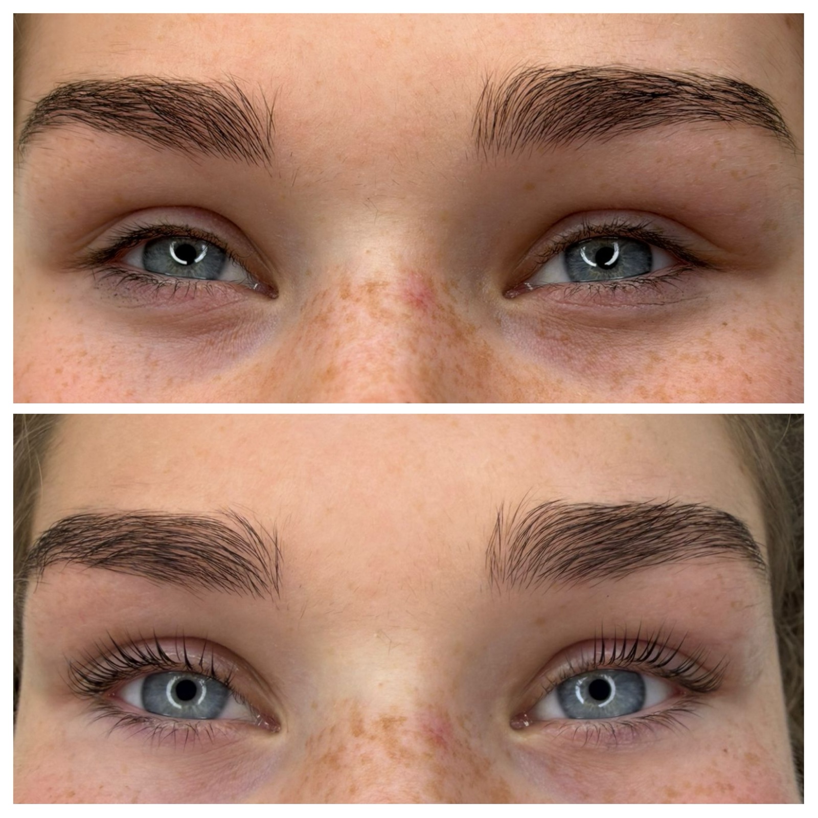 Brow treatment